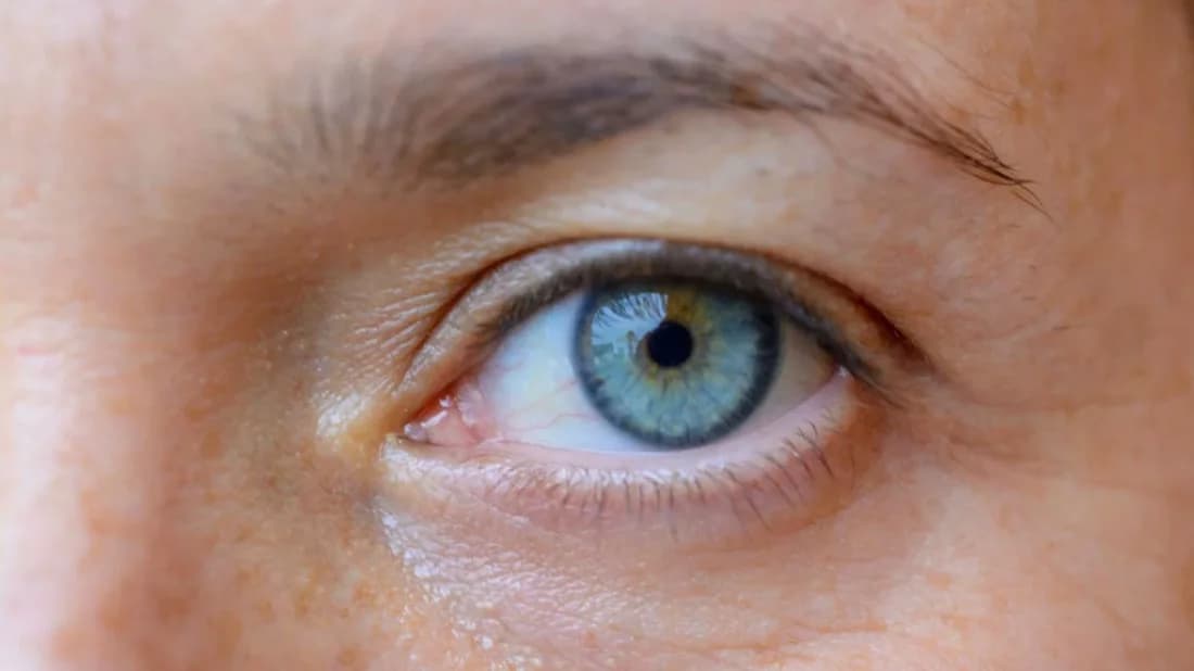 চোখের সুস্থতায় ২০-২০-২০ নিয়ম