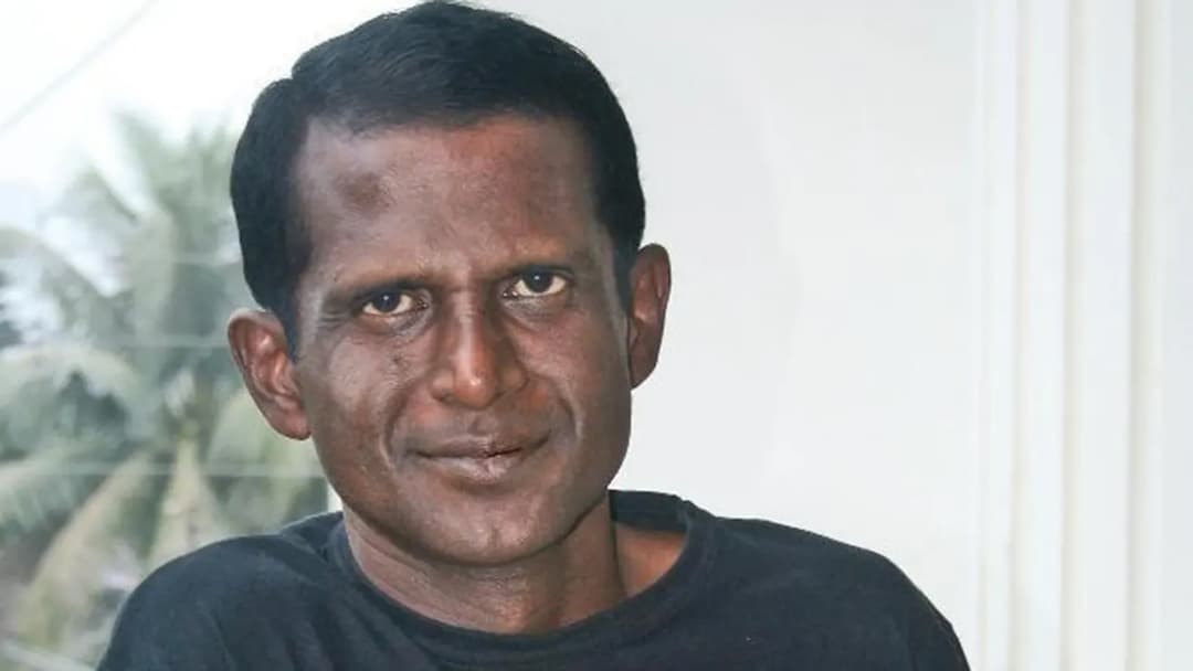 দুই সপ্তাহ ধরে হাসপাতালে চিকিৎসাধীন হাসান মাসুদ