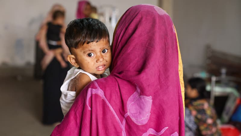 হাম ও হামের উপসর্গ নিয়ে দেশে আরও ১১ শিশুর মৃত্যু