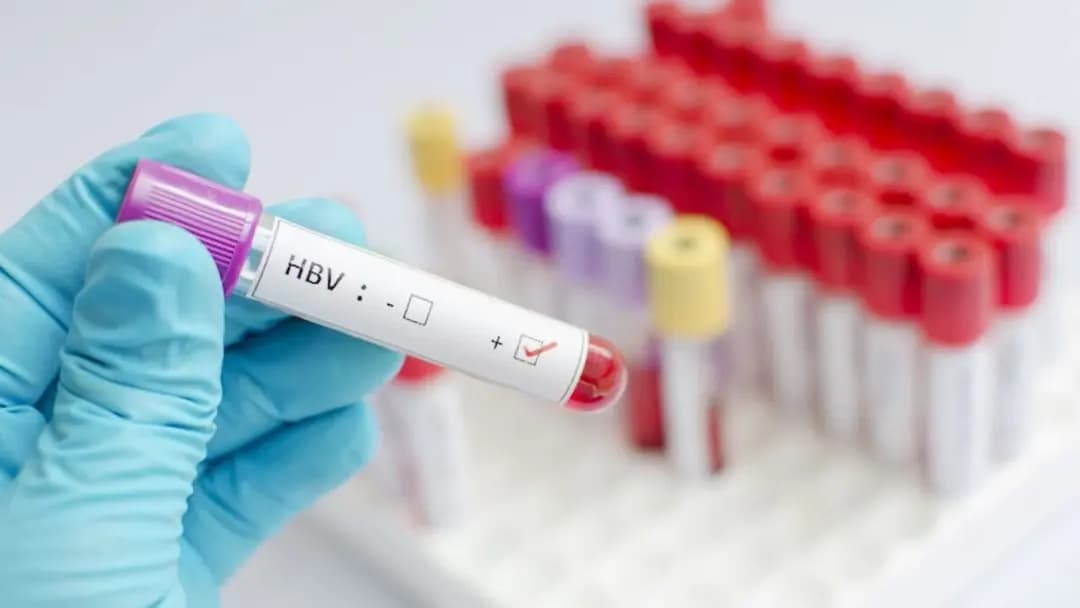 এক বছরে বিশ্বজুড়ে হেপাটাইটিস বি কমেছে ৩২ শতাংশ